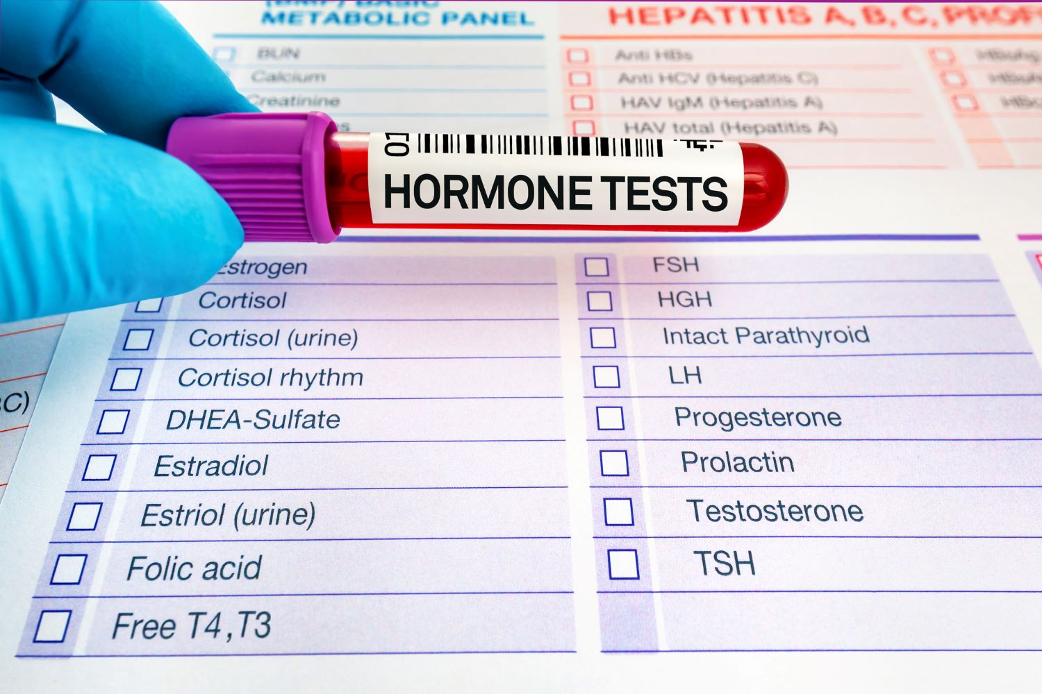 Hormonski testovi: Kome su i zašto potrebni